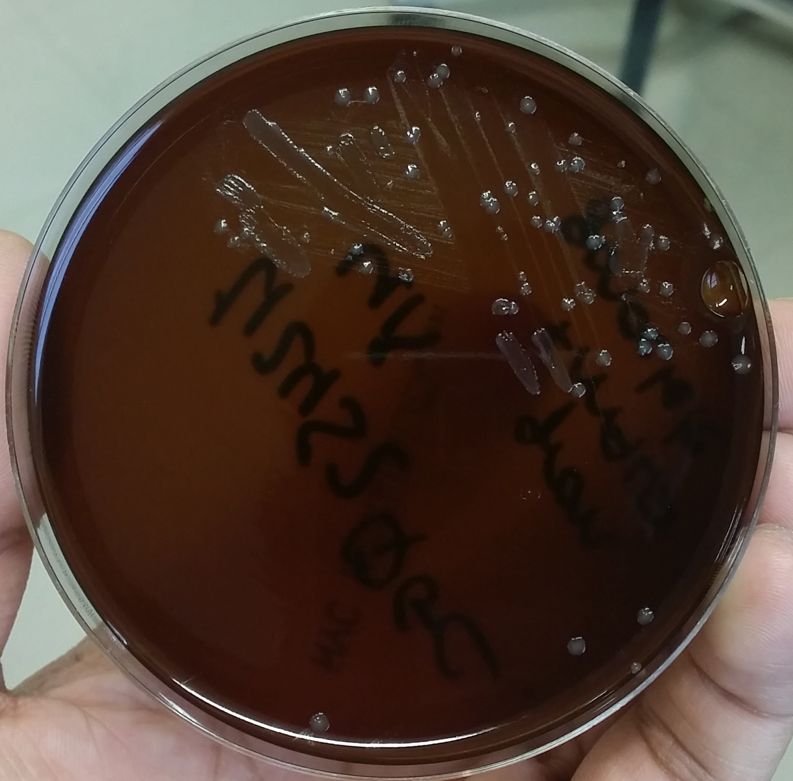  Культура гонококков на питательной среде из агар-агара.